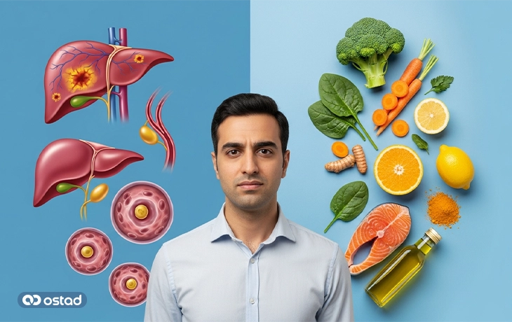 رژیم غذایی کلانژیت