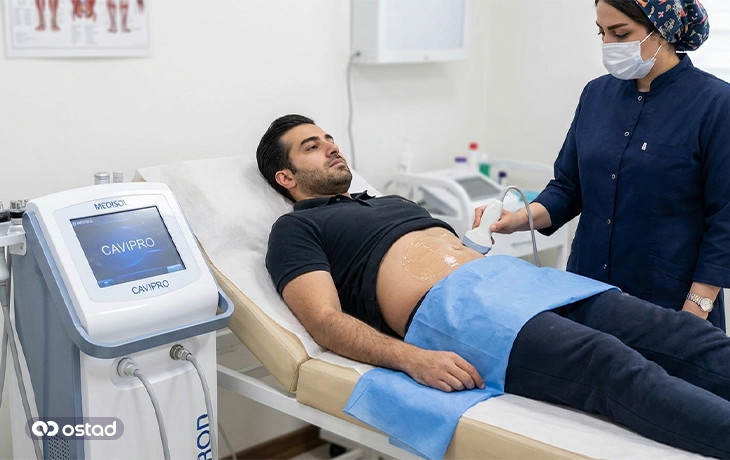 لاغری با دستگاه کویتیشن