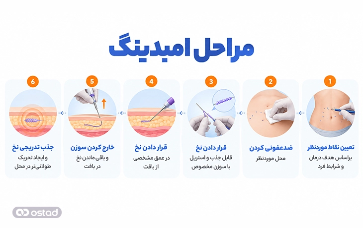 مراحل انجام امبدینگ