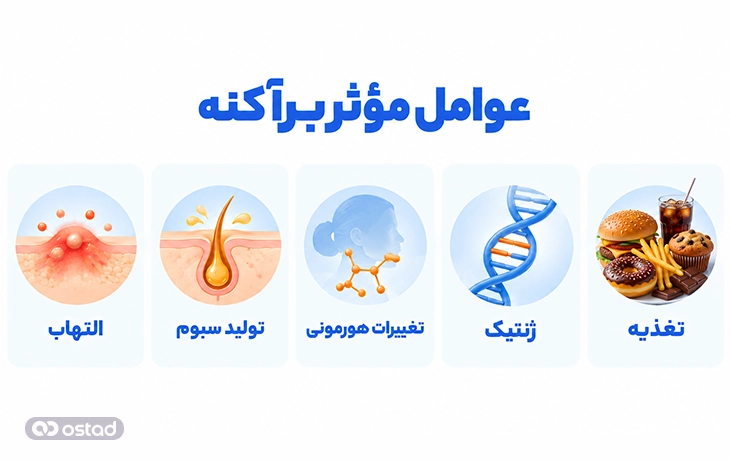 عوامل مؤثر بر آکنه